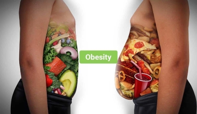 Saint Lucians Overweight, Ministry of Health says
